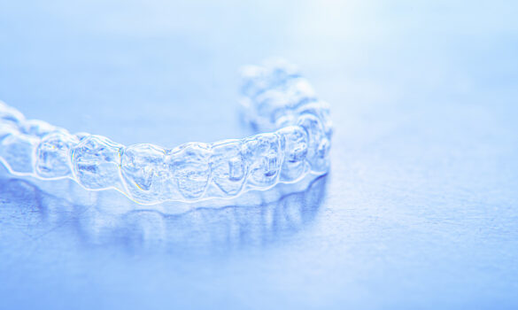 Picture of an Invisalign aligner against a light blue background.