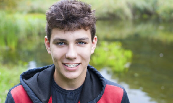 Picture of a teenage boy with braces standing in front of a lake and smiling at the camera.