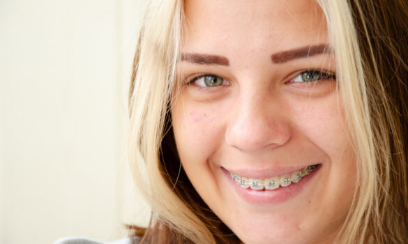 Picture of a teenage girl with braces smiling at the camera.